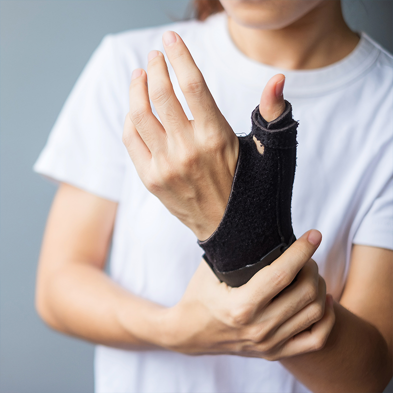 Upper Extremity Prosthetics